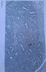 Imagen de biopsia de ginebra mascota de canespasion basado en un caso real